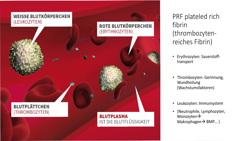 PRP Darstellung 1