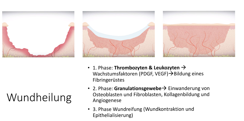 PRP Darstellung 2